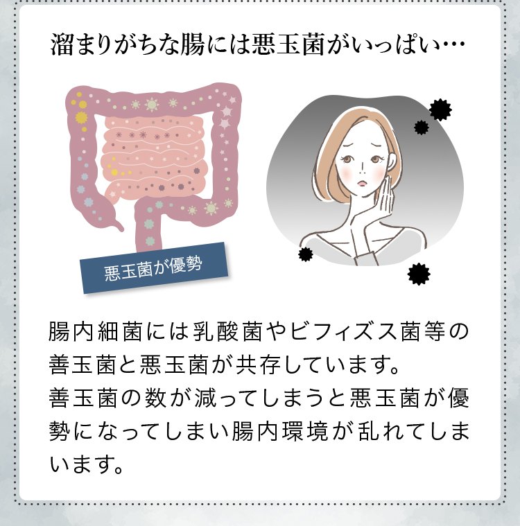 溜まりがちな腸には悪玉菌がいっぱい…腸内細菌には乳酸菌やビフィズス菌等の善玉菌と悪玉菌が共存しています。善玉菌の数が減ってしまうと悪玉菌が優勢になってしまい腸内環境が乱れてしまいます。
