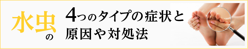 水虫の4つのタイプの症状と原因や対処法