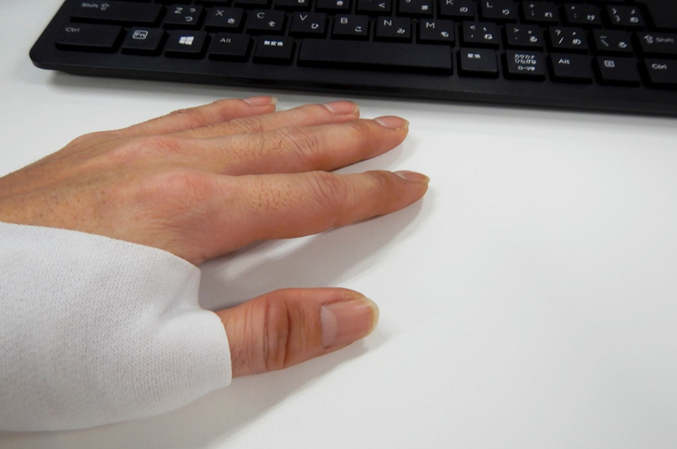 腱鞘炎はどのように診断されますか?